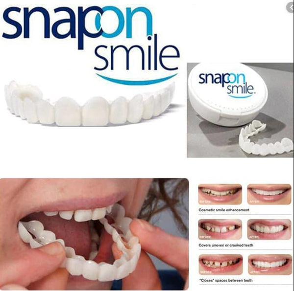 2 Pairs Snap-On Teeth Covers – Natural Look, Instant Smile Upgrade