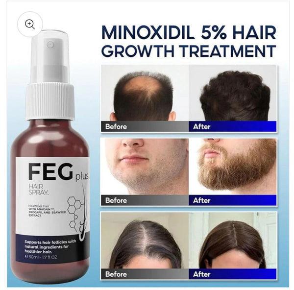 FEG PLUS Hair Growth Spray | 100% ORIGNAL - FREE DELIVERY