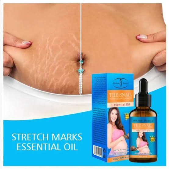 Aichun Beauty Stretch Marks Oil  100% Results