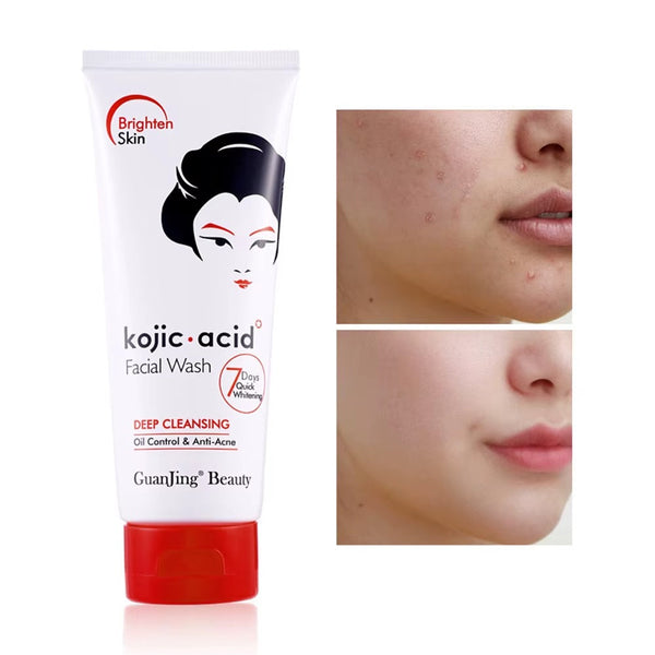 Sadoer Amino Acids Hyaluronic acids Kojic acid Mild Oil Control Cleanser